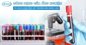Công dụng của ống nghiệm