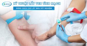 Lấy ven