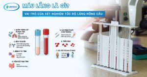 Máu lắng là gì