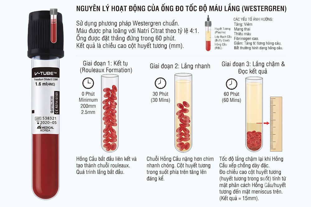 Nguyên lý hoạt động của ống đo tốc độ máu lắng
