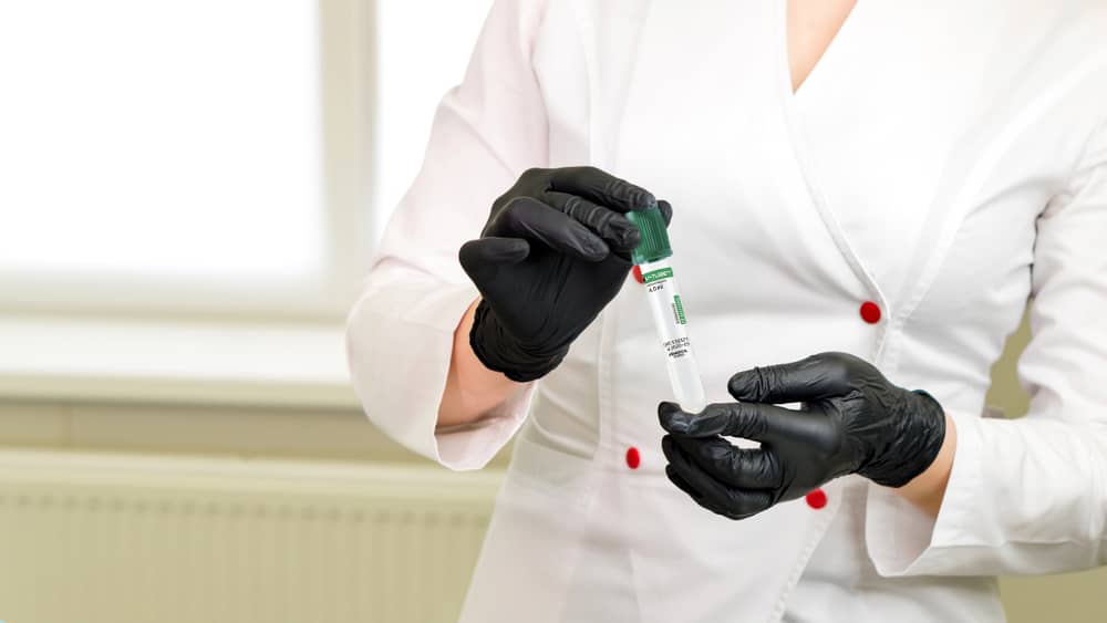 Ống heparin sử dụng để làm gì
