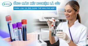 Ống máu xét nghiệm