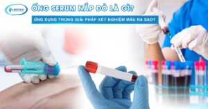 Ống Serum nắp đỏ