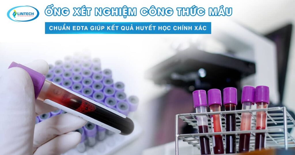 Ống xét nghiệm công thức máu