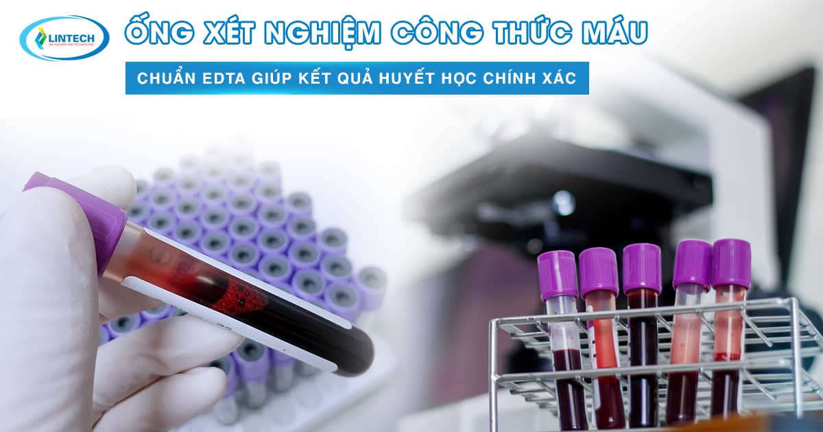 Ống xét nghiệm công thức máu