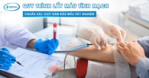 Quy trình lấy máu tĩnh mạch