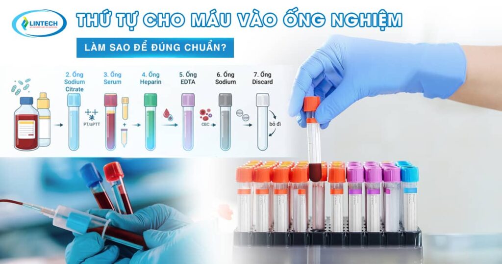 Thứ tự cho máu vào ống nghiệm