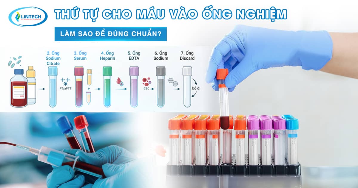 Thứ tự cho máu vào ống nghiệm