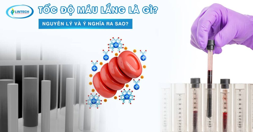 Tốc độ máu lắng