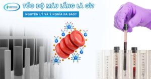 Tốc độ máu lắng