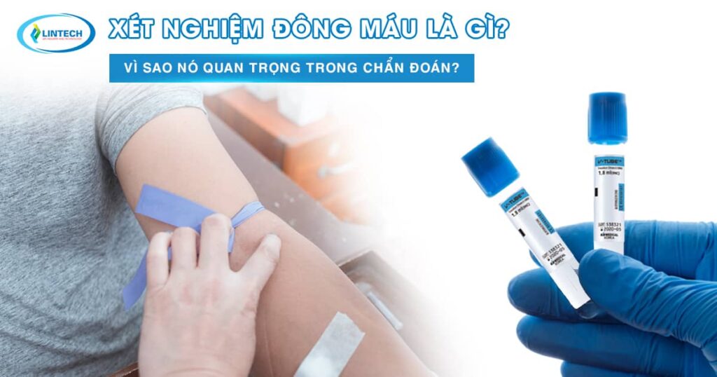 Xét nghiệm đông máu