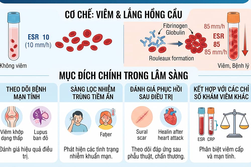 Xét ngheiemj máu lắng để làm gì