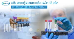 Xét nghiệm sinh hóa máu