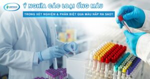 Ý nghĩa các loại ống máu
